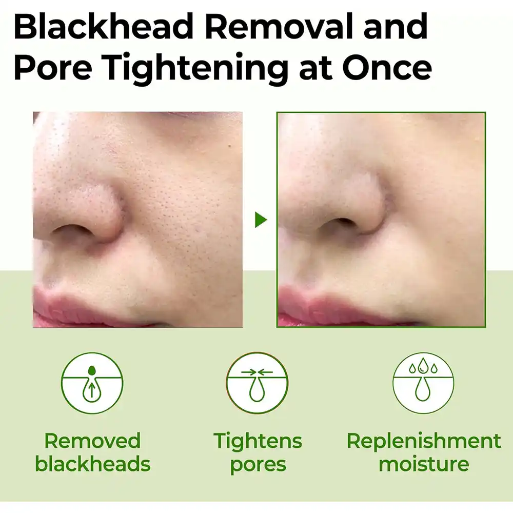 ونر کوچک کننده منافذ سوپر ماچا سام بای می SOME BY MI Super Matcha Pore Tightening Toner 150ml