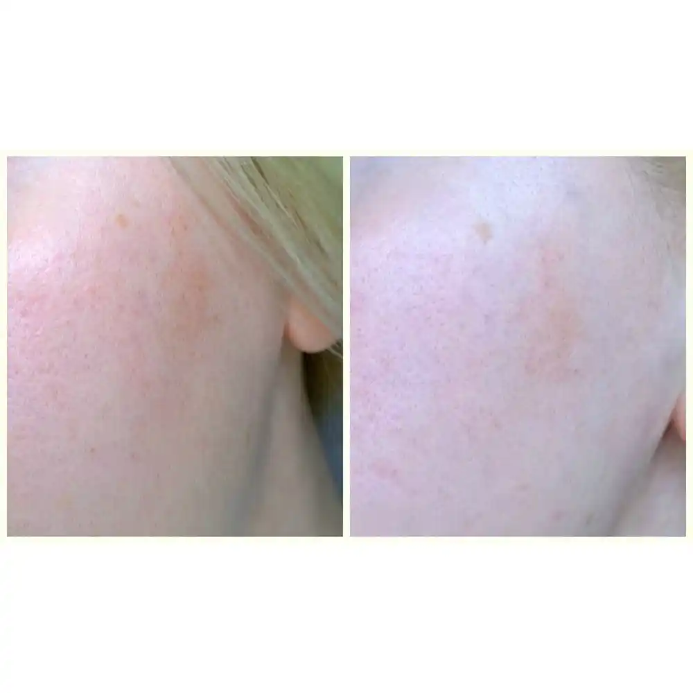 سرم ضد جوش و آبرسان 30 روزه میراکل سام بای می SOME BY MI AHA BHA PHA 30 Days Miracle Serum 50ml