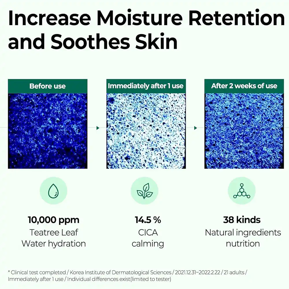 سرم ضد جوش و آبرسان 30 روزه میراکل سام بای می SOME BY MI AHA BHA PHA 30 Days Miracle Serum 50ml
