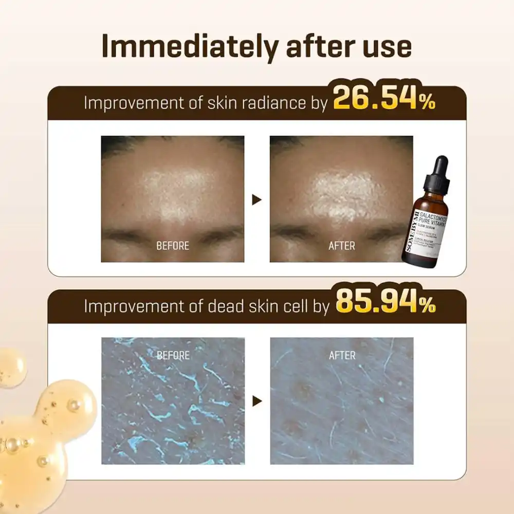 سرم ویتامین سی گالاکتومایسس سام بای می Some By Mi Galactomyces Pure Vitamin C Glow Serum 30ml
