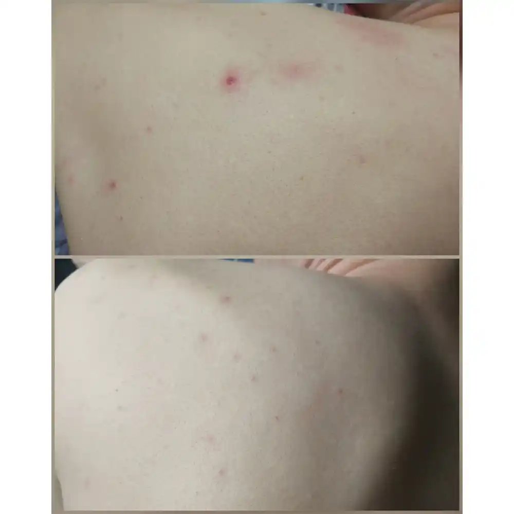 شوینده بدن ضد جوش 30 روزه میراکل سام بای می SOME BY MI Miracle Acne Clear Body Cleanser 400g