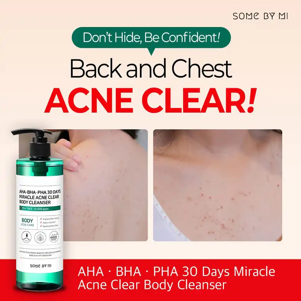 شوینده بدن ضد جوش 30 روزه میراکل سام بای می SOME BY MI Miracle Acne Clear Body Cleanser 400g