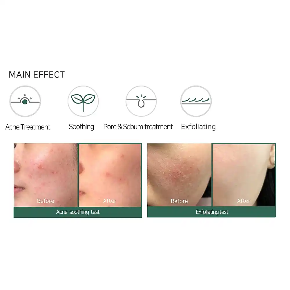 فوم ضد جوش لایه بردار میراکل سام بای می SOME BY MI AHA BHA PHA 30 Days Miracle Acne Clear Foam 100ml