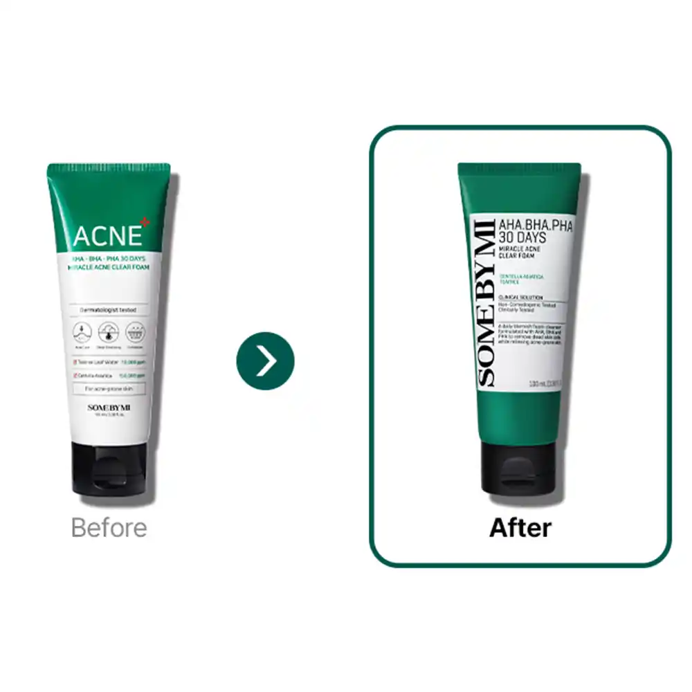 فوم ضد جوش لایه بردار میراکل سام بای می SOME BY MI AHA BHA PHA 30 Days Miracle Acne Clear Foam 100ml