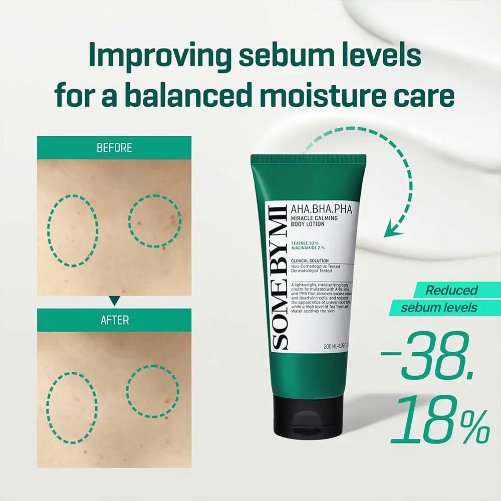 لوسیون بدن میراکل ضد جوش سام بای می SOME BY MI Miracle Calming Body Lotion 200ml