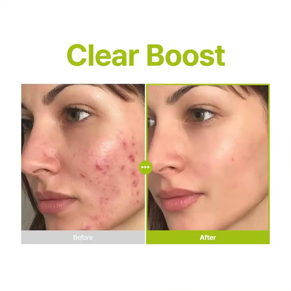 سرم آزلائیک اسید ۱۰٪، کوجیک اسید و تی تری پیوریتو PURITO Azelaic Kojic Tea Tree Serum | ضد لک، ضد جوش و تسکین‌دهنده پوست