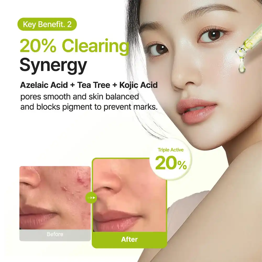 سرم آزلائیک اسید ۱۰٪، کوجیک اسید و تی تری پیوریتو PURITO Azelaic Kojic Tea Tree Serum | ضد لک، ضد جوش و تسکین‌دهنده پوست