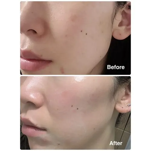 کرم مرطوب کننده گلوتاتیون ابیب ضد لک، روشن کننده و تقویت سد دفاعی پوست Abib Glutathiosome Cream Vita Tube