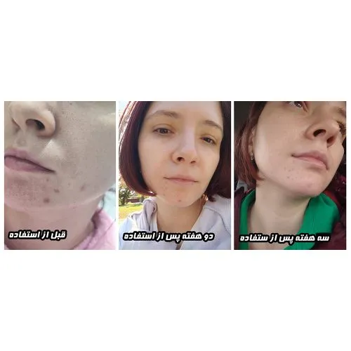 سرم روشن کننده بیوتی اف جوسان حاوی سنتلا و ویتامین سی Beauty of Joseon Light On Serum Centella Vita C