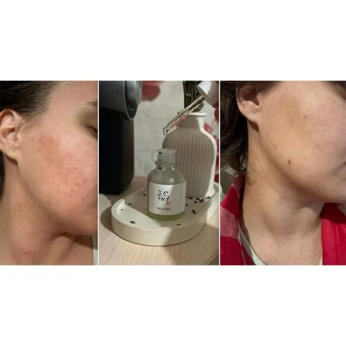 سرم ضد التهاب و آبرسان چای سبز و پنتنول بیوتی اف جوسان Beauty of Joseon Calming Serum Green Tea Panthenol