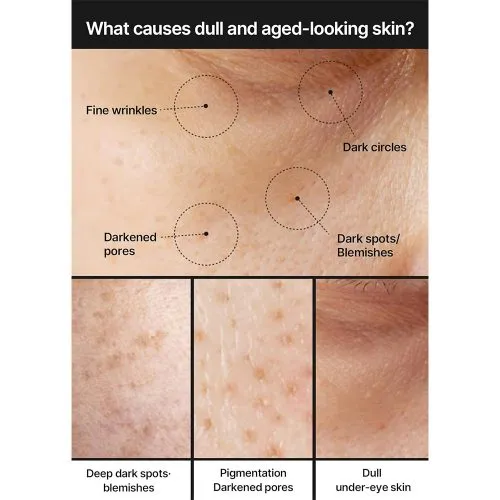 کرم ضد لک و کنترل منافذ سلیمکس روشن کننده پوست Celimax PoreDark Spot Brightening Cream