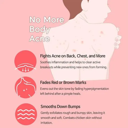 وسیون بدن ضد لک و روشن کننده تیام TIAM Anti Blemish Body Lotion