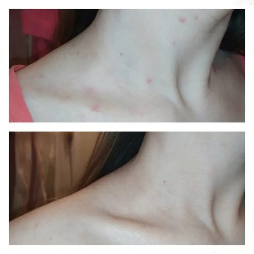 وسیون بدن ضد لک و روشن کننده تیام TIAM Anti Blemish Body Lotion
