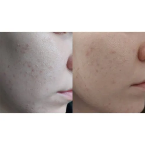 یست تونر ضد لک و روشن کننده نیاسینامید تیام TIAM Vita B3 Mist Toner