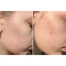 تونر لایه‌بردار و شفاف‌کننده AHA/BHA کوزارکس در سایت «بانو»