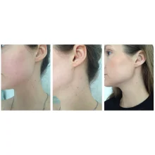 تونر لایه‌بردار و شفاف‌کننده AHA/BHA کوزارکس در سایت «بانو»