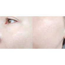 ژل شستشوی گود مورنینگ کوزارکس PH پایین