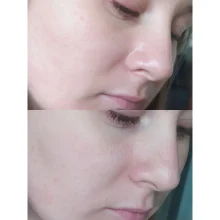تونر عصاره پروپولیس و عسل و پنتنول کوزارکس