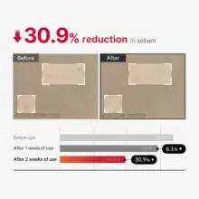 اسپری لایه بردار و ضد جوش بدن مدی کیوب اصل مدل Medicube Red Acne Body Peeling Shot مناسب کاهش جوش بدن، زبری پوست، استرابری اسکین، پاکسازی منافذ و صاف شدن پوست بدن