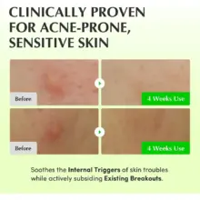 تونر PDRN آلوئه‌ورا اکوال بری EQQUALBERRY Aloe Calming Toner تسکین‌دهنده پوست حساس کره‌ای 150ml