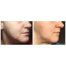 تونر-ضد-جوش-و-آبرسان-30-روزه-میراکل-سام-بای-می-Some-By-Mi-AHA-BHA-PHA-30-Days-Miracle-Toner-150ml