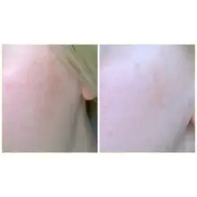 تونر-ضد-جوش-و-آبرسان-30-روزه-میراکل-سام-بای-می-Some-By-Mi-AHA-BHA-PHA-30-Days-Miracle-Toner-150ml