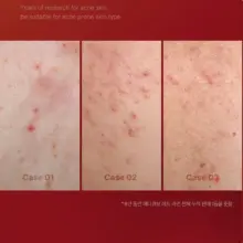 تونر ضد جوش و تسکین دهنده مدی کیوب اصل مدل Medicube Red Toner 2.0