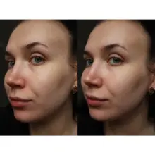 تونر ضد لک و روشن کننده یوجانیاسین سام بای می SOME BY MI Yuja Niacin Brightening Toner 150ml