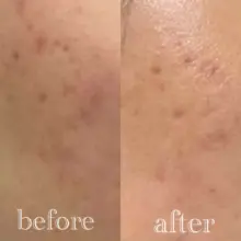 عکس تونر لایه بردار و روشن کننده گلیکولیک اسید7% اوردینری اصل