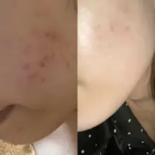 عکس تونر لایه بردار و روشن کننده گلیکولیک اسید7% اوردینری اصل