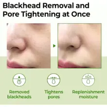 ونر-کوچک-کننده-منافذ-سوپر-ماچا-سام-بای-می-SOME-BY-MI-Super-Matcha-Pore-Tightening-Toner-150ml