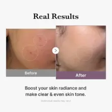 تونر گلوتاتیون مدی کیوب اصل مدل Medicube Age-R Glutathione Glow Milky Toner مناسب روشن شدن پوست، آبرسانی، افزایش شفافیت، یکنواخت شدن رنگ پوست و ایجاد گلس اسکین