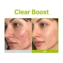 سرم آزلائیک اسید ۱۰٪، کوجیک اسید و تی تری پیوریتو PURITO Azelaic Kojic Tea Tree Serum | ضد لک، ضد جوش و تسکین‌دهنده پوست