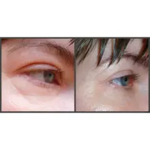 سرم ضد چروک و پر کننده خطوط صورت و دور چشم آرژیرلین 10% اوردینری اصل