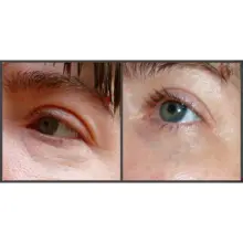 سرم ضد چروک و پر کننده خطوط صورت و دور چشم آرژیرلین 10% اوردینری اصل