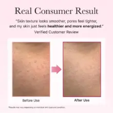 سرم دور چشم و صورت PDRN آرنسیا Arencia PDRN Booster Shot Serum 30ml | ترمیم‌کننده، جوانساز و ضد چروک پوست