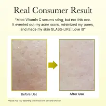 سرم دور چشم و صورت ویتامین C بوستر شات آرنسیا Arencia Vitamin C Booster Shot Serum | روشن‌کننده، ضد لک و مرطوب‌کننده پوست