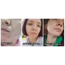 سرم-روشن-کننده-بیوتی-اف-جوسان-حاوی-سنتلا-و-ویتامین-سی-Beauty-of-Joseon-Light-On-Serum-Centella-Vita-C-