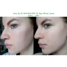 سرم-ضد-جوش-و-آبرسان-30-روزه-میراکل-سام-بای-می-SOME-BY-MI-AHA-BHA-PHA-30-Days-Miracle-Serum-50ml