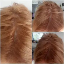 سرم ضد ریزش و پرپشت کننده مو اوردینری Multi-Peptide اصل؛ راهکار تخصصی برای افزایش تراکم و تقویت ریشه موها.