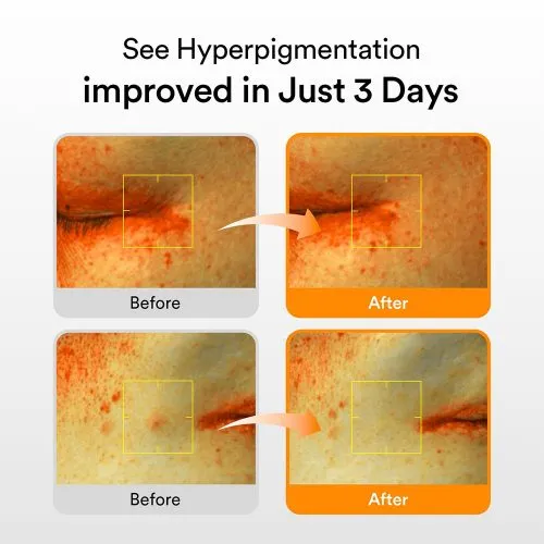سرم-ضد-لک-و-روشن-کننده-گلوتاتیون-ابیب-Abib-Glutathiosome-Dark-Spot-Serum-Vita-Drop