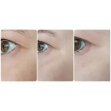 سرم ضد چروک و روشن‌کننده دور چشم رولی سرامید فارم استی Farmstay Ceramide Wrinkle Care Relaxing Rolling Eye Serum 25ml با اپلیکاتور سه توپی ماساژور حاوی نیاسینامید و سرامید