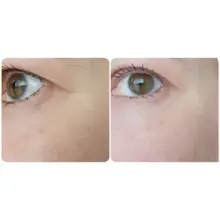 سرم ضد چروک و روشن‌کننده دور چشم رولی سرامید فارم استی Farmstay Ceramide Wrinkle Care Relaxing Rolling Eye Serum 25ml با اپلیکاتور سه توپی ماساژور حاوی نیاسینامید و سرامید