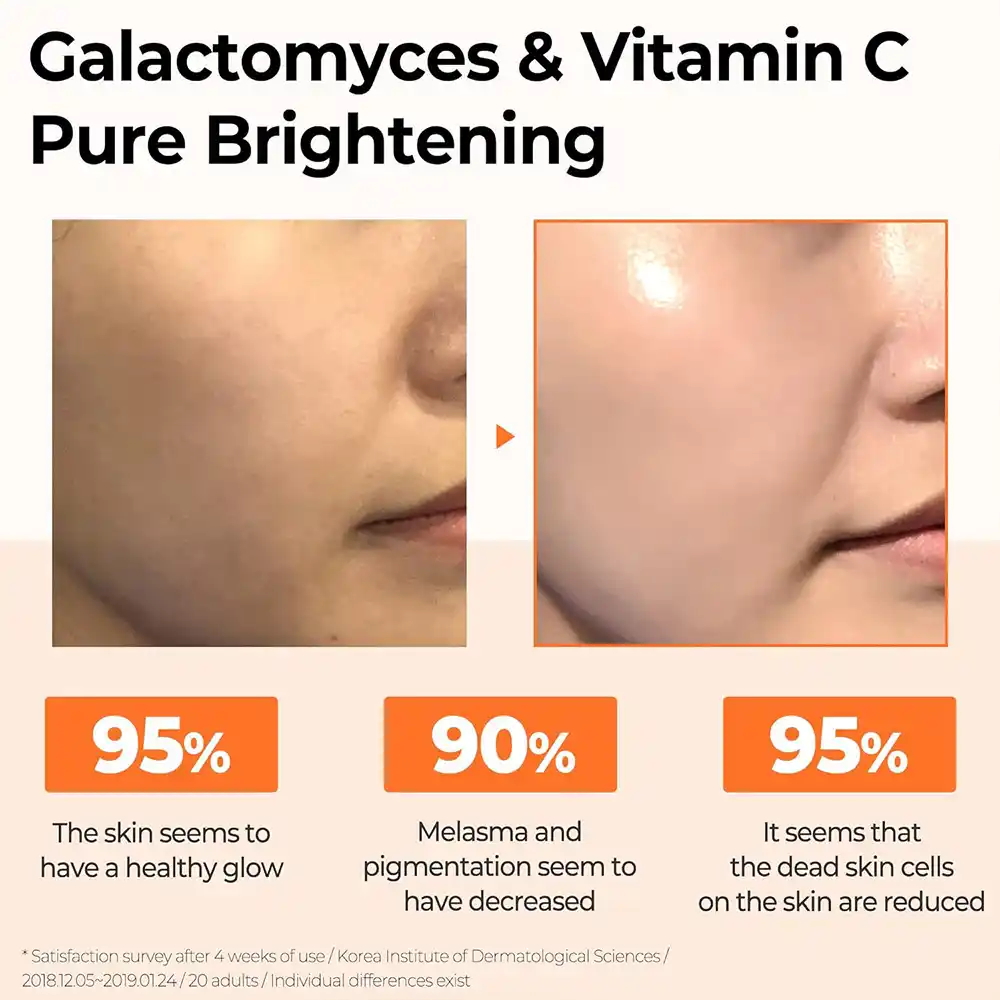 سرم-ویتامین-سی-گالاکتومایسس-سام-بای-می-Some-By-Mi-Galactomyces-Pure-Vitamin-C-Glow-Serum-30ml