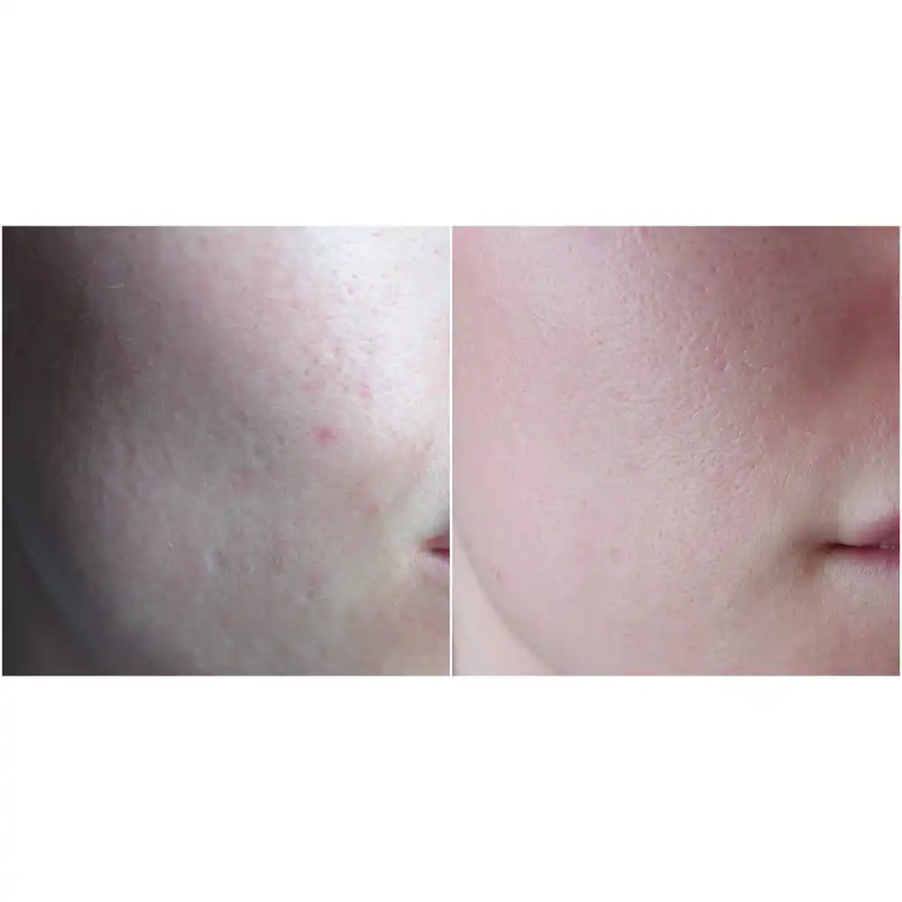 سرم-ویتامین-سی-گالاکتومایسس-سام-بای-می-Some-By-Mi-Galactomyces-Pure-Vitamin-C-Glow-Serum-30ml