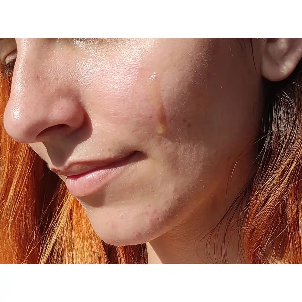 سرم-ویتامین-سی-گالاکتومایسس-سام-بای-می-Some-By-Mi-Galactomyces-Pure-Vitamin-C-Glow-Serum-30ml