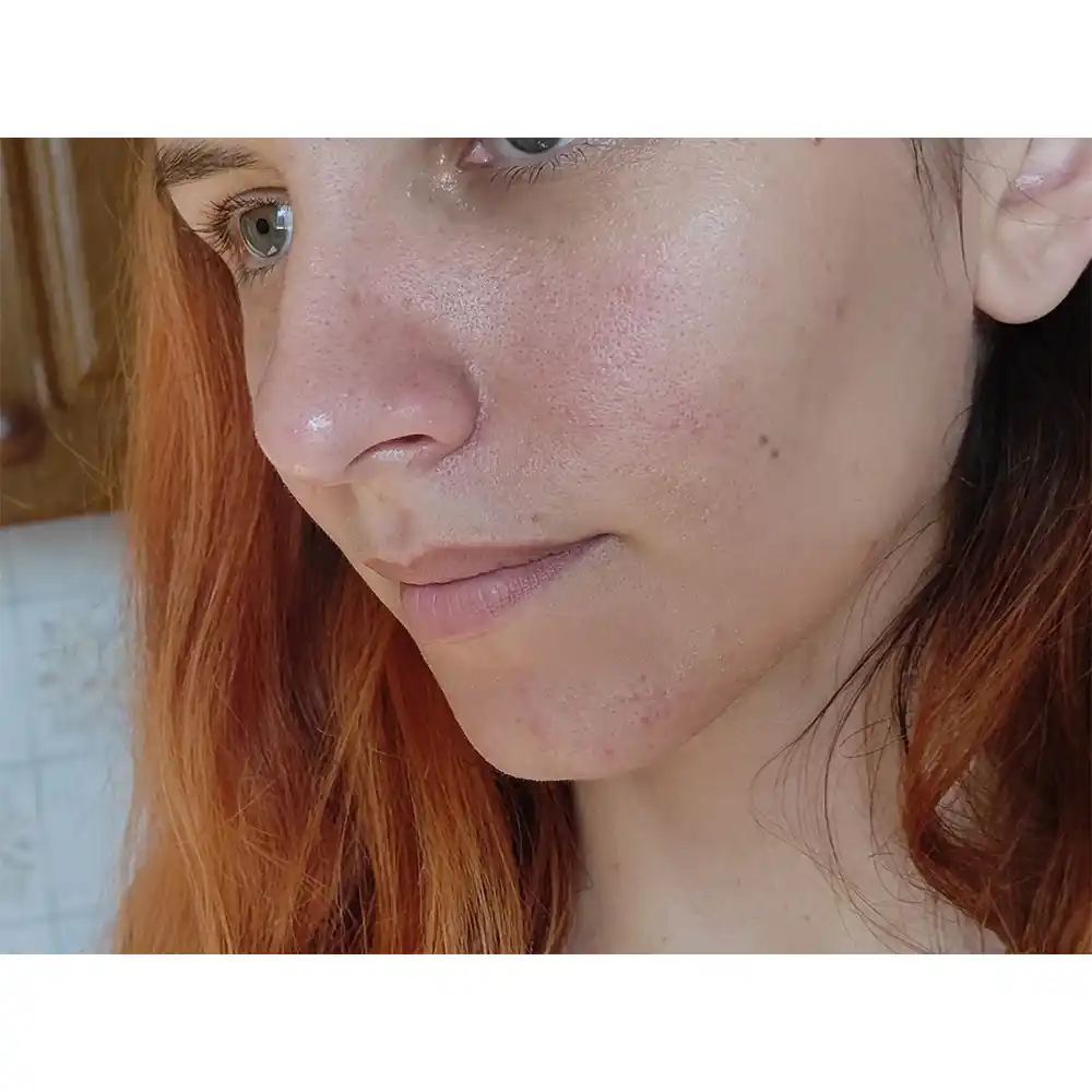 سرم-ویتامین-سی-گالاکتومایسس-سام-بای-می-Some-By-Mi-Galactomyces-Pure-Vitamin-C-Glow-Serum-30ml