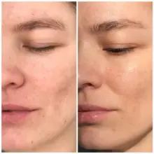 سرم-ویتامین-سی-گالاکتومایسس-سام-بای-می-Some-By-Mi-Galactomyces-Pure-Vitamin-C-Glow-Serum-30ml