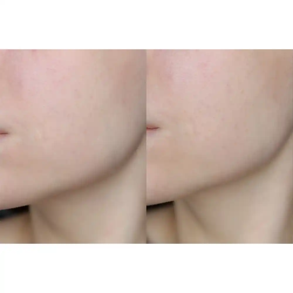 سرم-ویتامین-سی-گالاکتومایسس-سام-بای-می-Some-By-Mi-Galactomyces-Pure-Vitamin-C-Glow-Serum-30ml