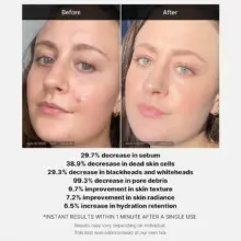 سرم پیلینگ سوکسینیک اسید مدی کیوب اصل مدل Medicube Red Acne Succinic Acid Peel، لایه‌بردار شستنی 21 درصد مناسب پوست جوش‌دار، منافذ، چربی اضافه، جوش سرسیاه و بافت ناهموار